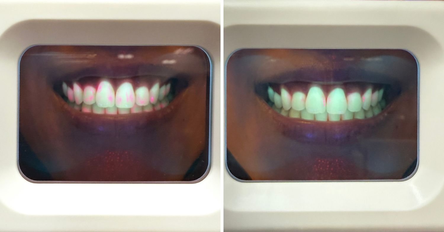 oral bacteria colgate total